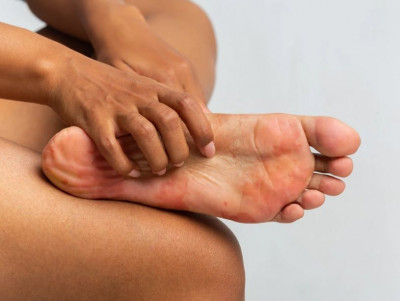 Cara Tepat Atasi Gatal di Kaki